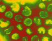 rubella-virus-particles-x300-000.jpg