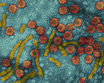 stds-s9-photo-of-hepatitis-b-virus.jpg